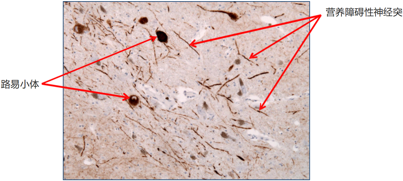 StressMarq——Alpha突触核蛋白&神经退行性疾病