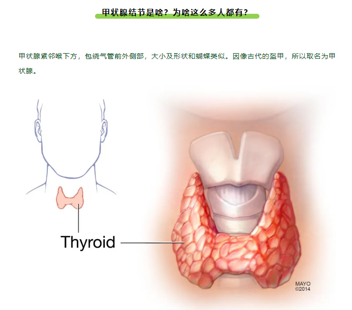 体检查出甲状腺结节，会不会变成癌？