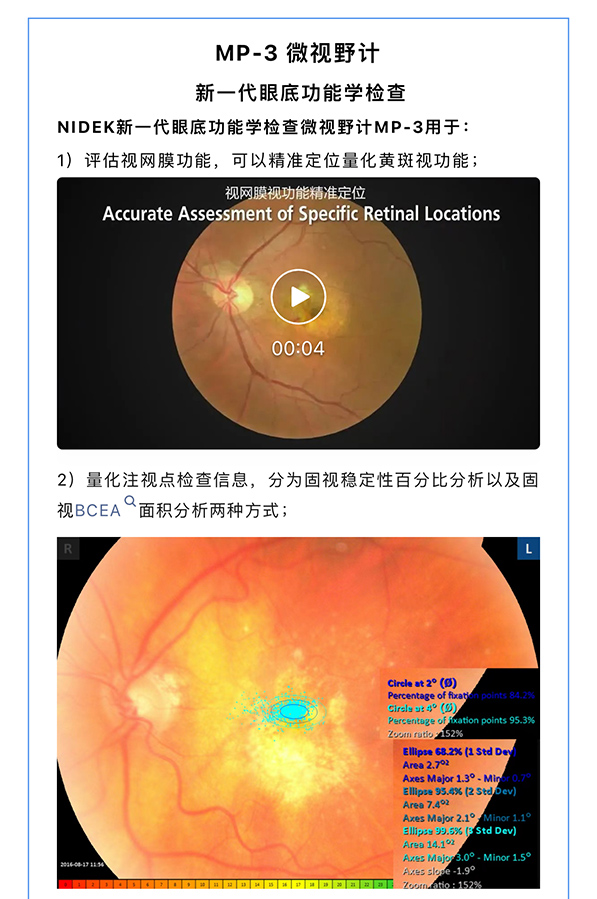 『量化黄斑视功能·从诊到治』——激光治疗的“指明灯”