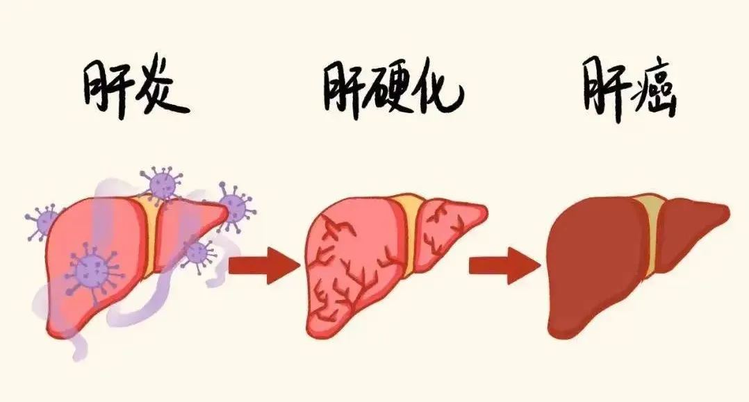 大众科普|早癌筛查知多少？