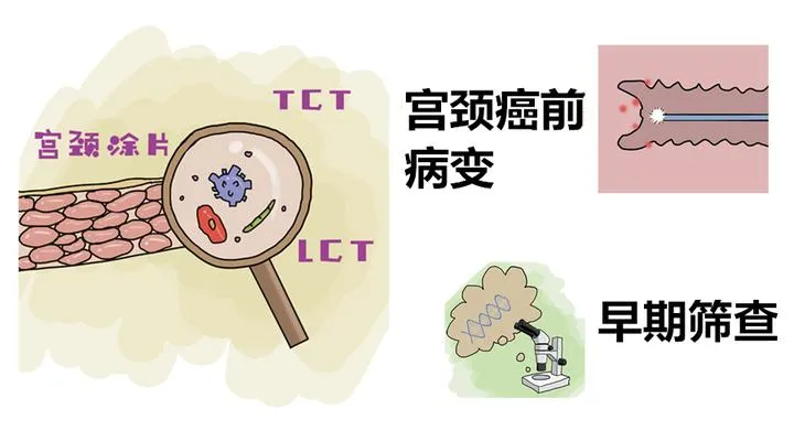 大众科普|早癌筛查知多少？