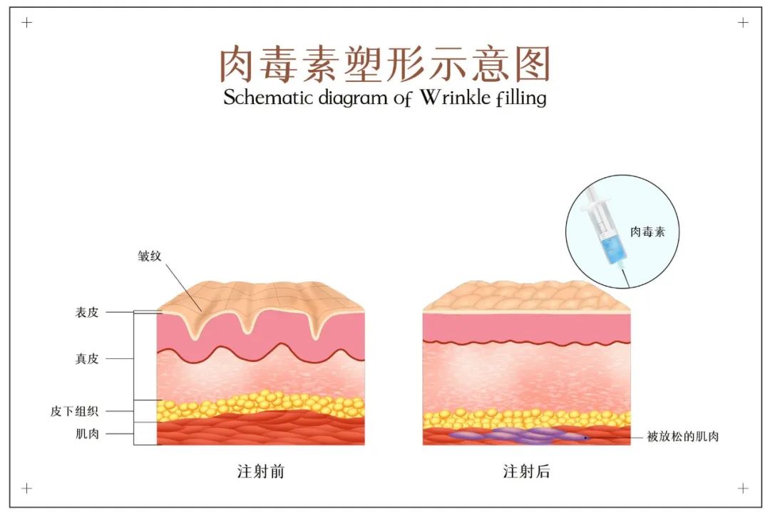 想拥有一张如明星般精致的小脸？