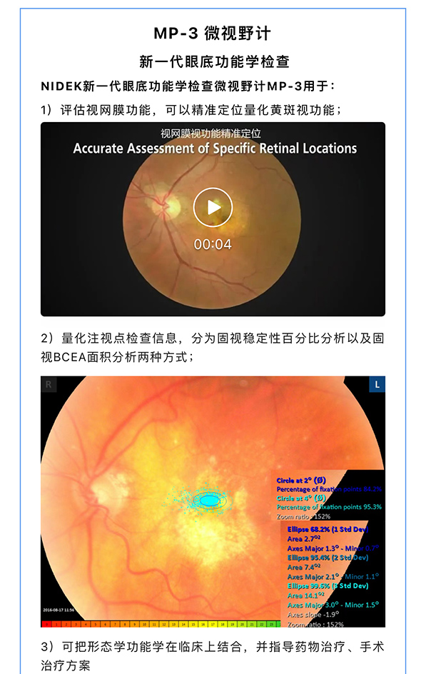 『量化黄斑视功能·从诊到治』— 微视野才是药物治疗的“金标准”