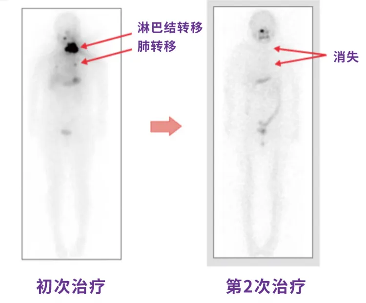  带您一起走进“神秘的核医学科”