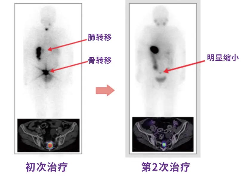  带您一起走进“神秘的核医学科”