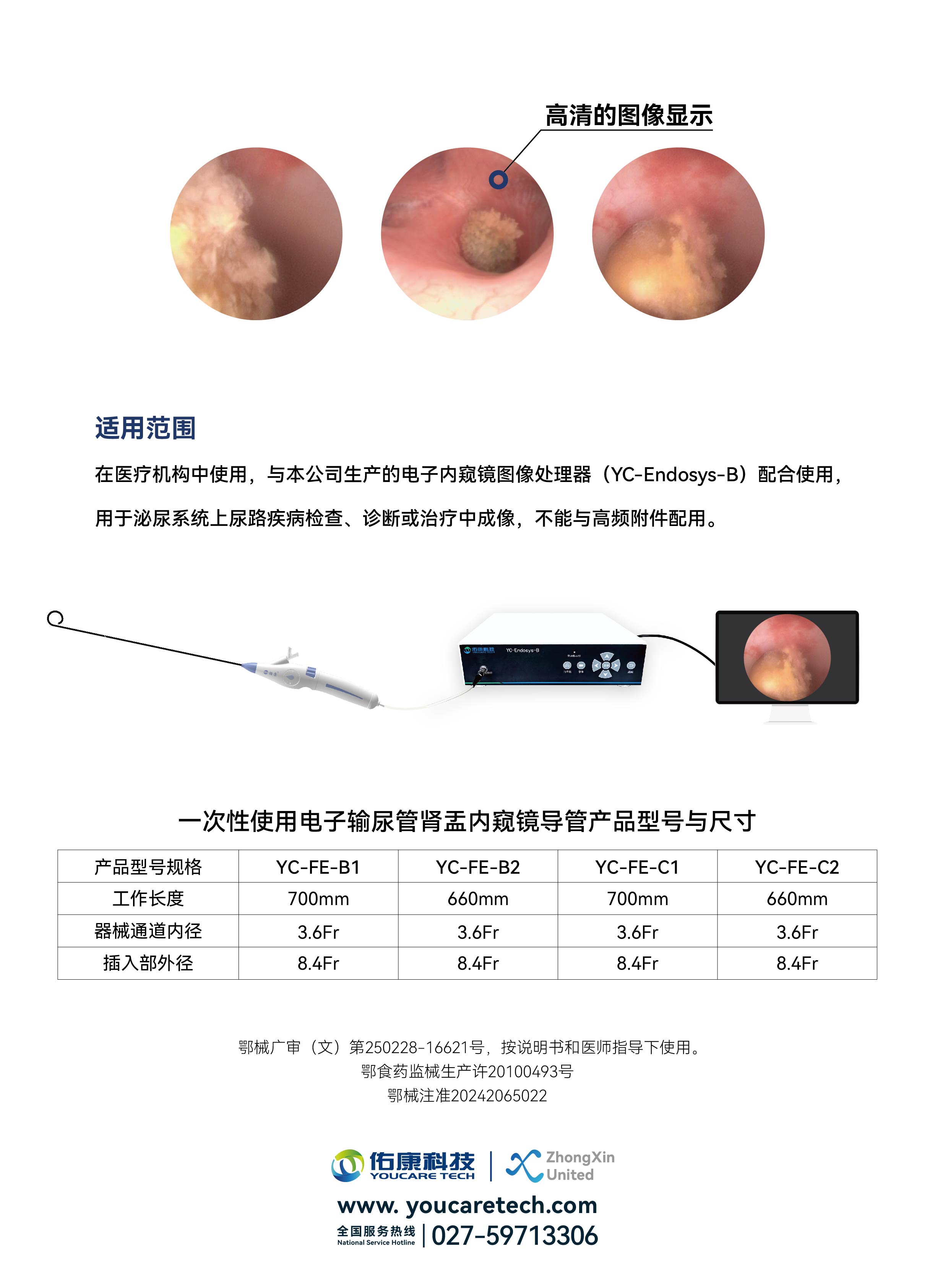 电子少刚®镜（一次性使用电子输尿管肾盂内窥镜导管）  