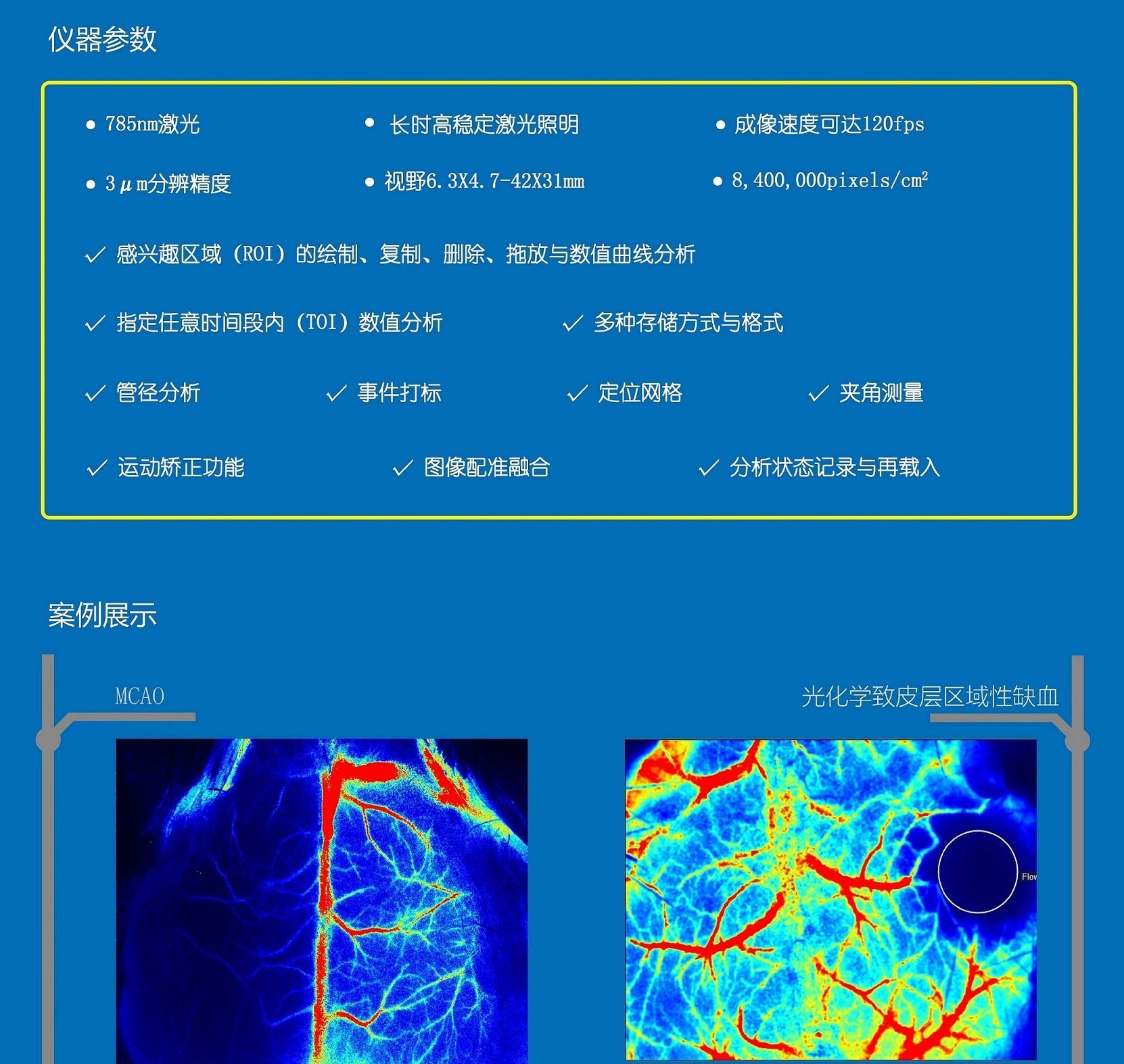 激光散斑血流成像仪