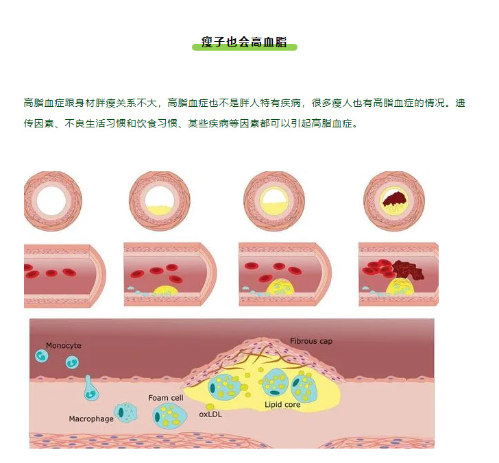 「我明明很瘦，为什么血脂却高了？」