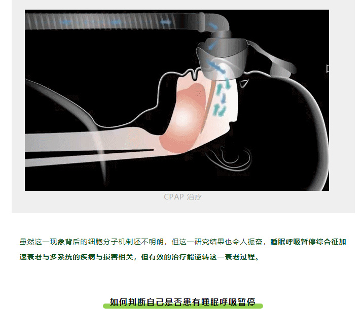 睡觉有这个「习惯」的人老得快！别急，还能逆转