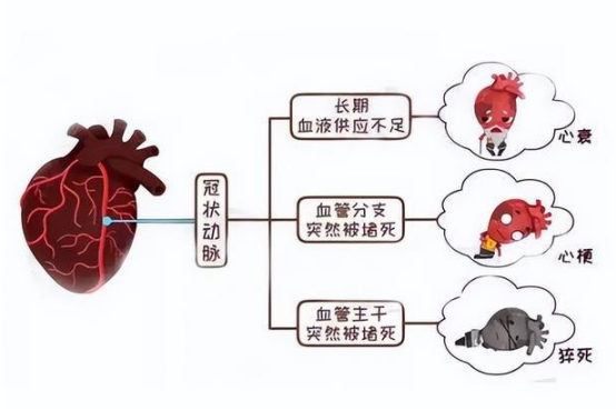 夏日炎炎如何预防心梗脑梗，贝斯曼给你答案