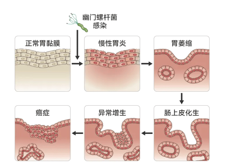 很多人得胃病，都是从沾上它开始的