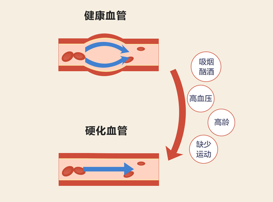 血管弹性与健康