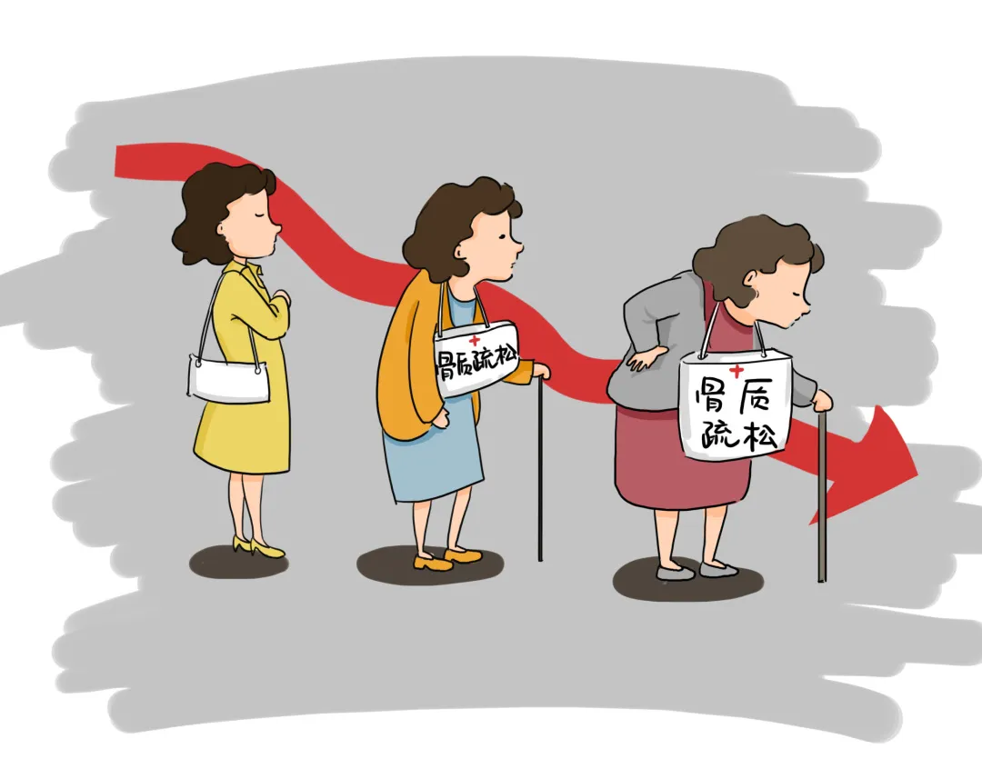大众科普|科学补钙,预防骨质疏松小窍门 大众科普|科学补钙,预防骨质疏松小窍门