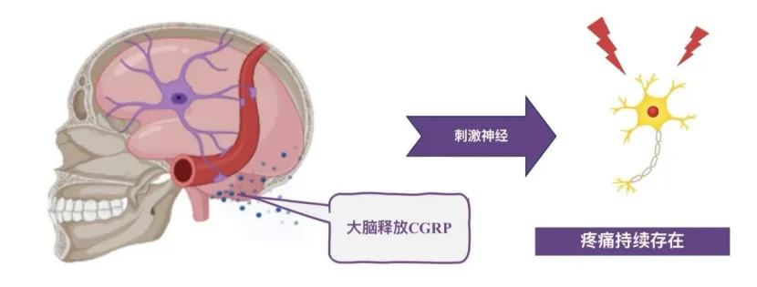 通知公告|我院头痛门诊正式开诊，一站式解决头痛困扰