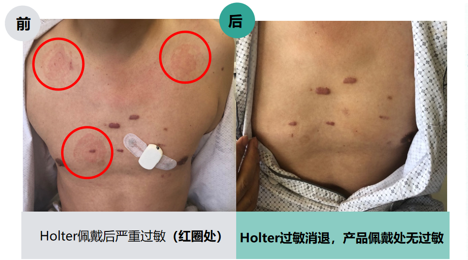 “智慧医疗设备,助力健康升级”——中关村品牌工程产品推介第三期 “智慧医疗设备,助力健康升级”——中关村品牌工程产品推介第三期