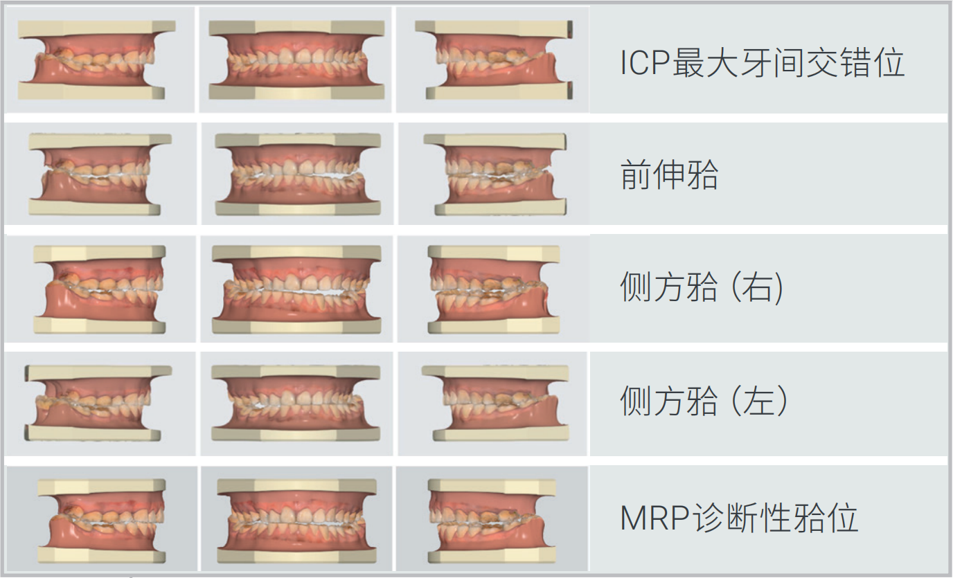 可扫多组咬合关系