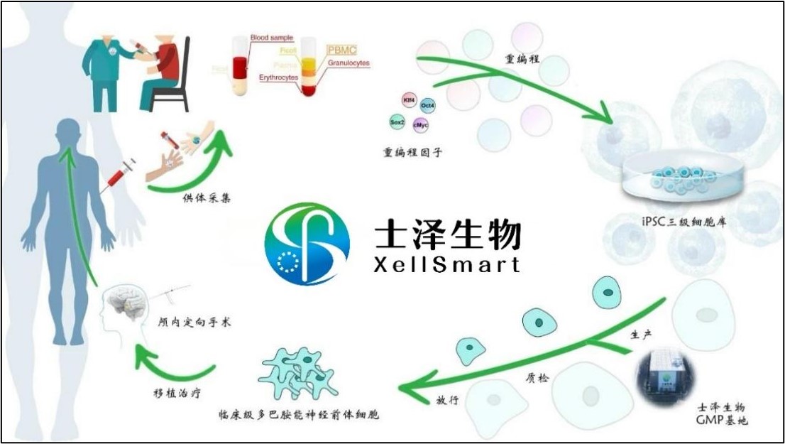 士泽生物通用细胞治疗帕金森病获中美药监局完全批准开展注册临床试验，将于国内顶级医院神经内外科开展 | 项目进展