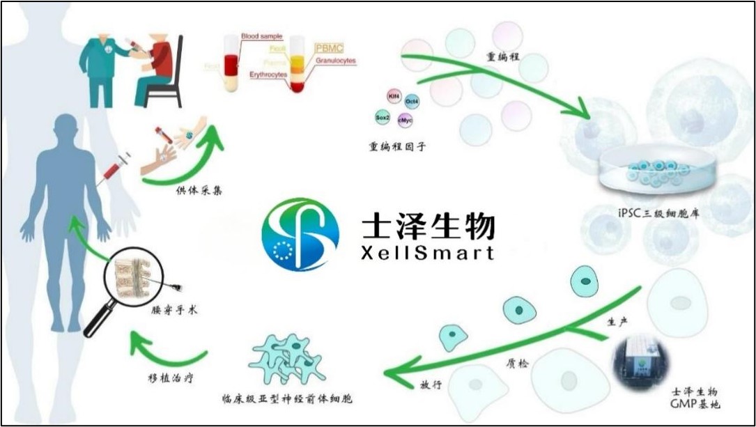 士泽生物通用细胞治疗帕金森病获中美药监局完全批准开展注册临床试验，将于国内顶级医院神经内外科开展 | 项目进展
