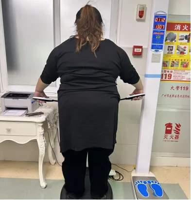 病例分享|肥胖与代谢病治疗中心|332 斤胖女孩的生死突围:从健康危机到新生蜕变 病例分享|肥胖与代谢病治疗中心|332 斤胖女孩的生死突围:从健康危机到新生蜕变