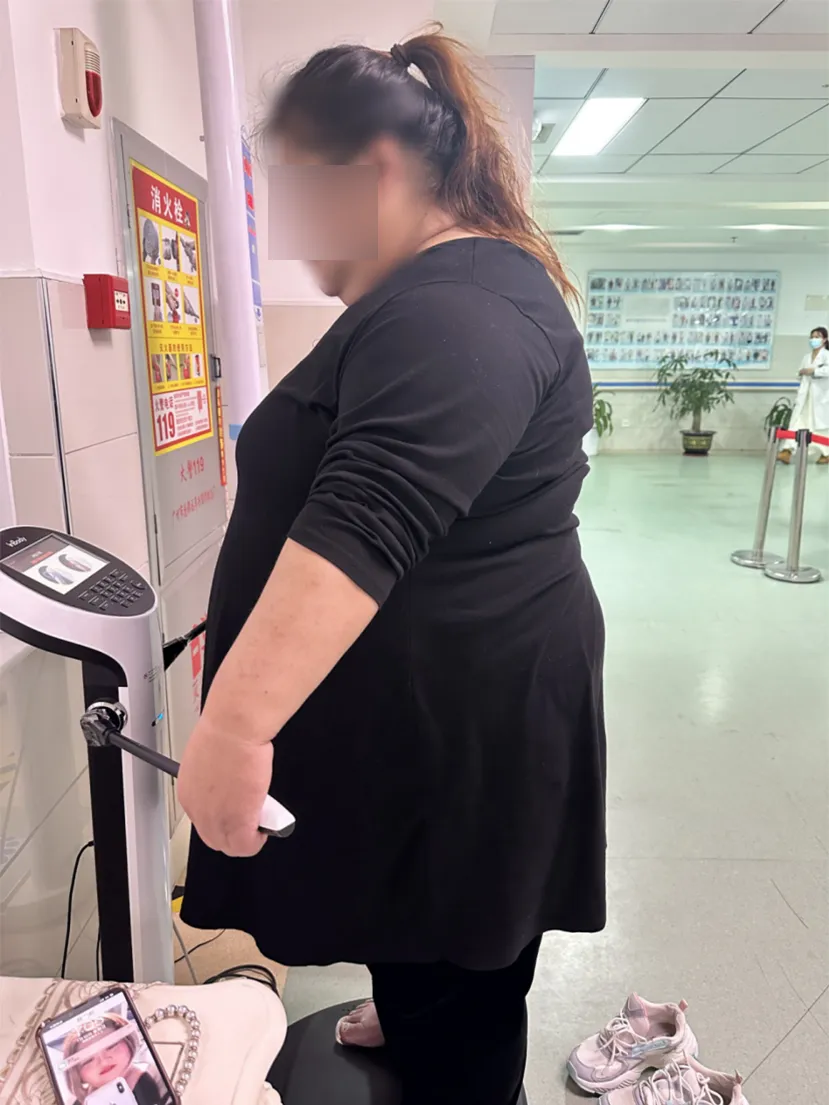 病例分享|肥胖与代谢病治疗中心|332 斤胖女孩的生死突围:从健康危机到新生蜕变 病例分享|肥胖与代谢病治疗中心|332 斤胖女孩的生死突围:从健康危机到新生蜕变