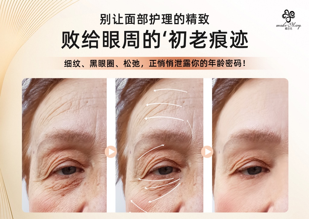 20-50岁眼纹护理策略：从“防初老”到“逆龄战”