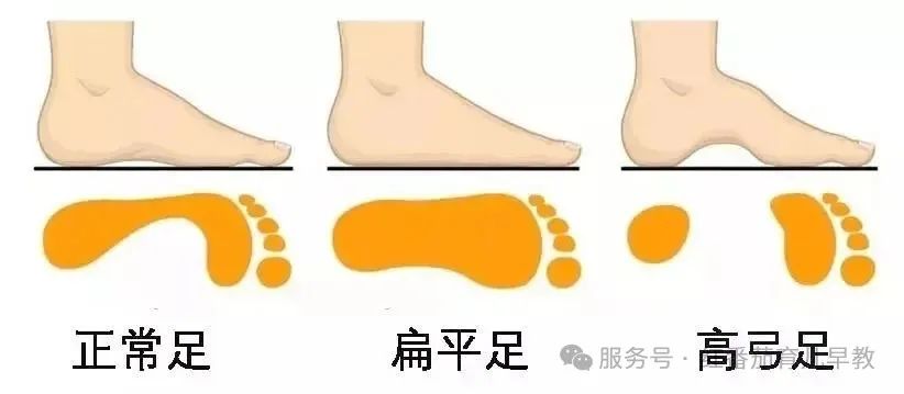 宝宝穿鞋VS光脚，这些发育差异家长一定要知道！