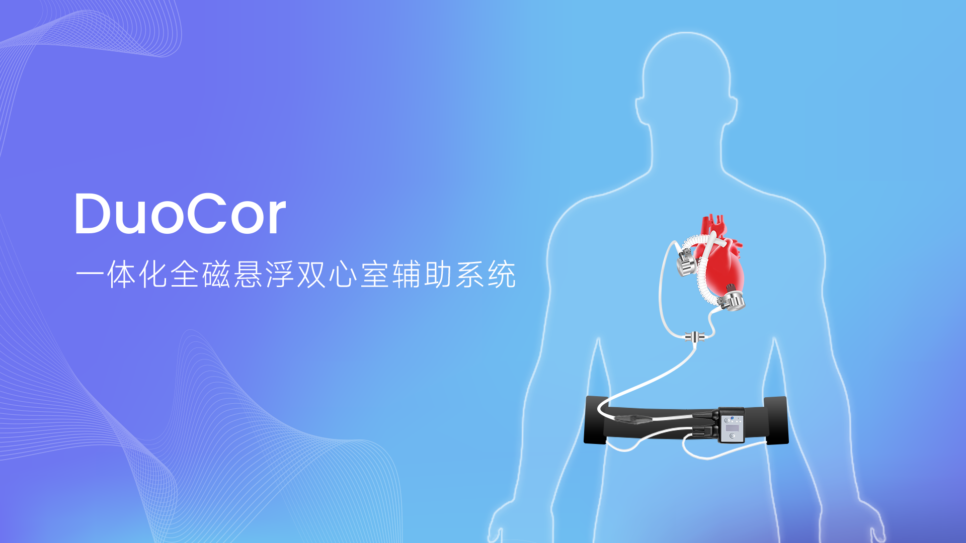 已投企业 | 核心医疗完成超1亿美元D轮融资,700+台植入量铸就人工心脏行业龙头企业 已投企业 | 核心医疗完成超1亿美元D轮融资,700+台植入量铸就人工心脏行业龙头企业