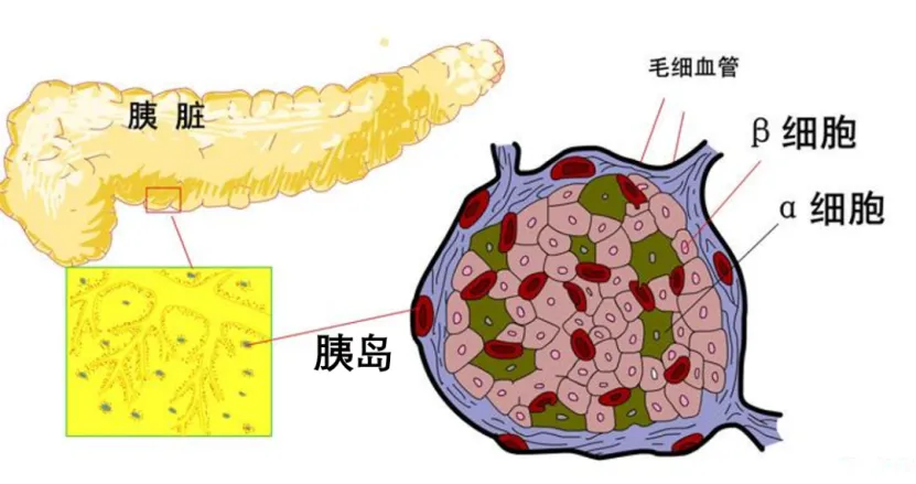 大众科普|糖尿病告别终身服药！ 用“2T疗法”唤醒胰岛细胞，血糖稳稳降下来！