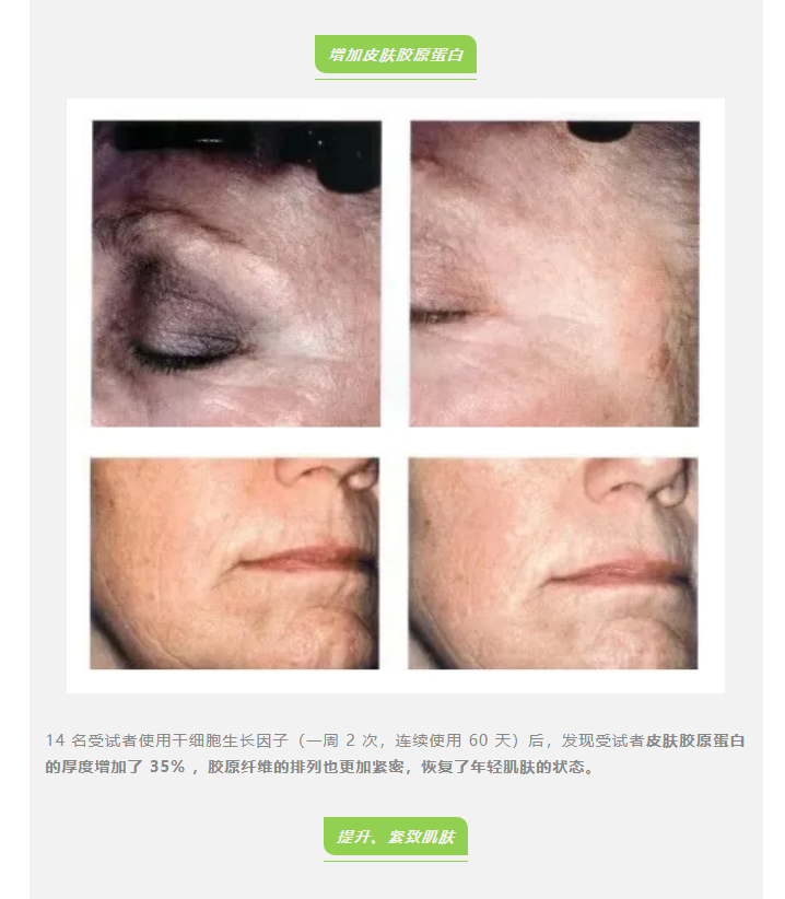 感觉突然变丑了?断崖式衰老真的会发生在这 3 个年龄段 感觉突然变丑了?断崖式衰老真的会发生在这 3 个年龄段