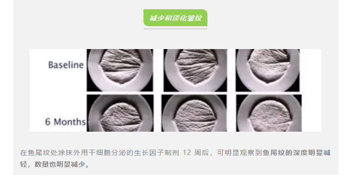 感觉突然变丑了?断崖式衰老真的会发生在这 3 个年龄段 感觉突然变丑了?断崖式衰老真的会发生在这 3 个年龄段